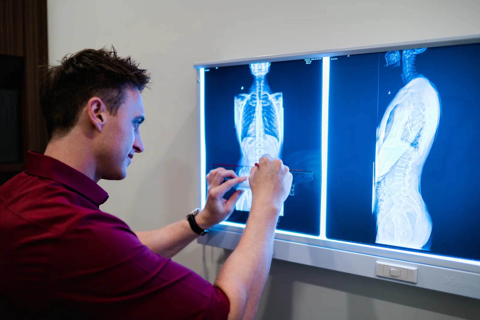 Scoliosis assessment at Elite Spine Centres.